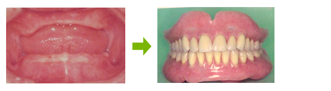 Dentures that truly fit will give you a brighter face